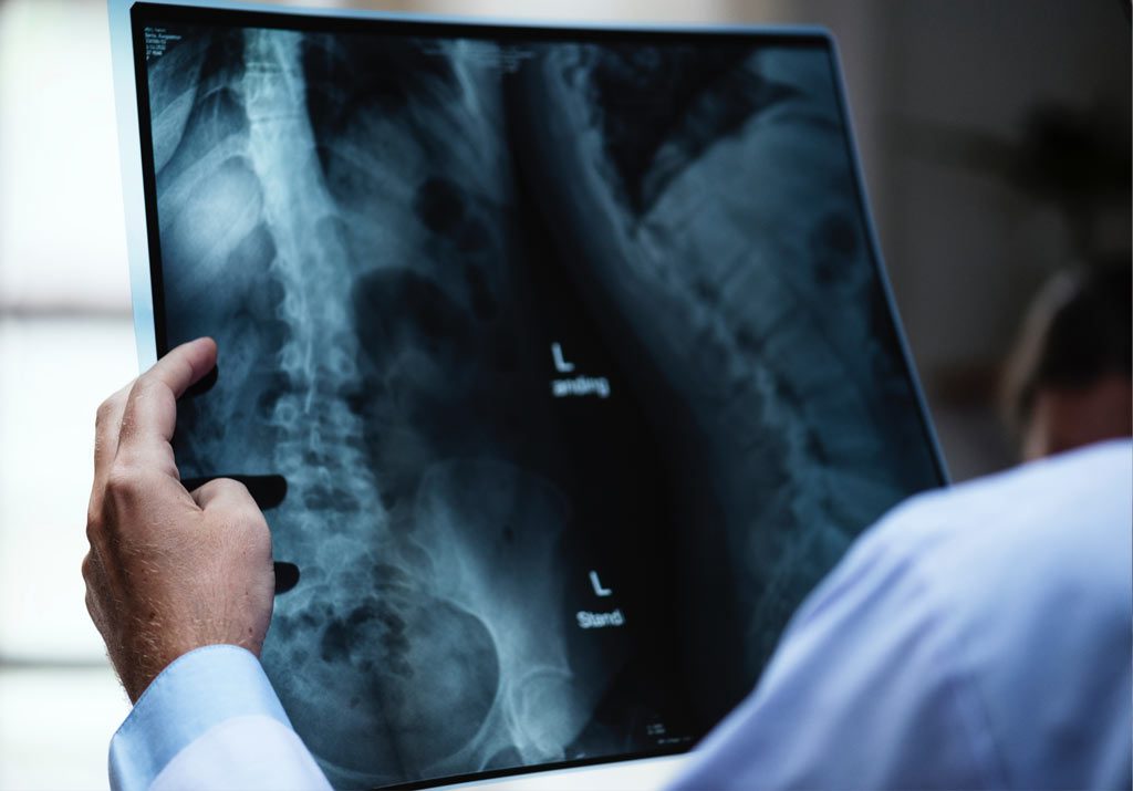 Patenting Medical Devices Patent Novelty vs. Commercial Novelty The
