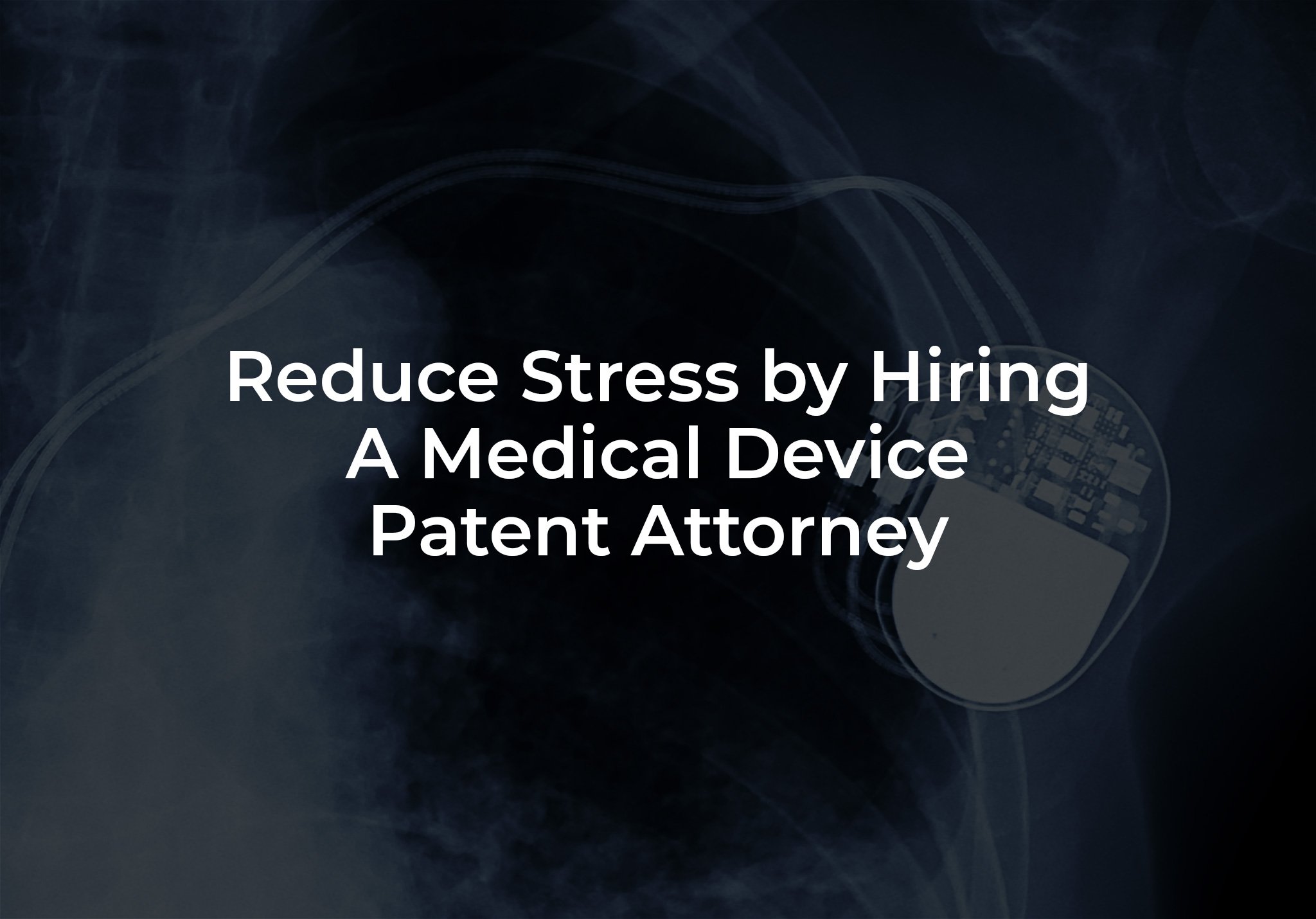 Reduce Stress by Hiring a Medical Device Patent Attorney
